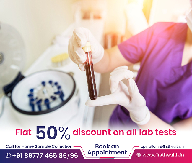 Exclusive Lab Test Packages!