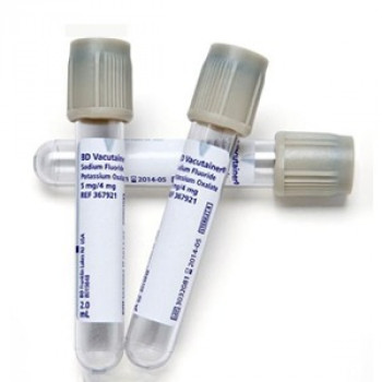 Glucose, Post Lunch (PLBS)